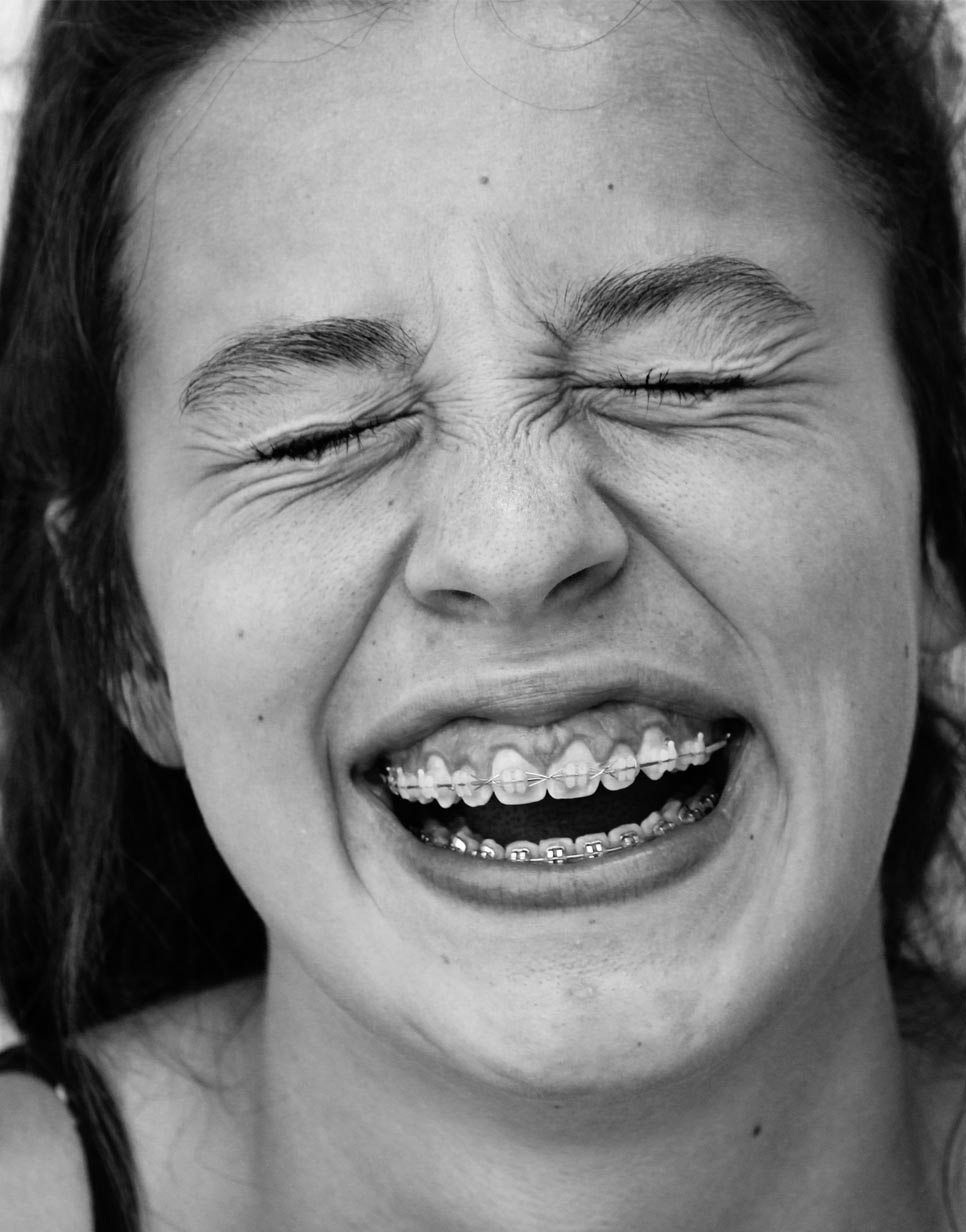 Sorriso com aparelho ortodôntico — Athena Odonto
